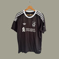 Liverpool arquero